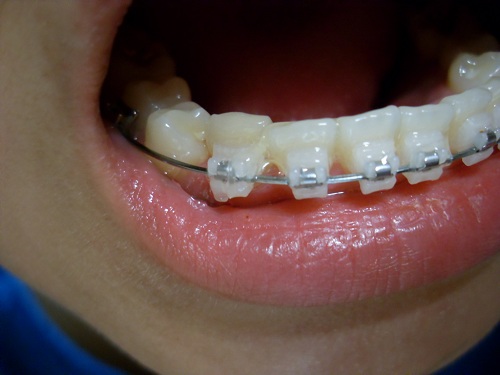 오라픽스 포스팅 사진 (7).JPG