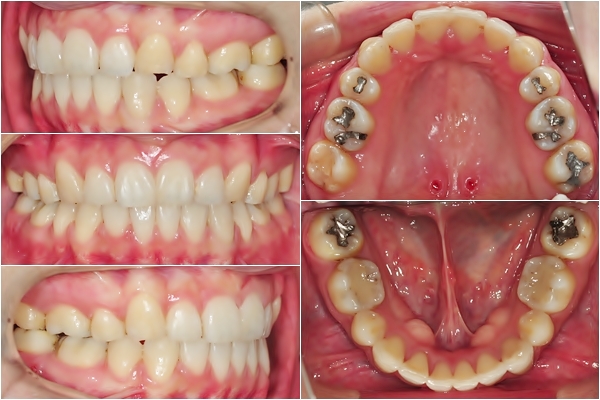 30. 킬본교정(1).jpg