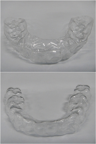 30.킬본교정 (7).jpg