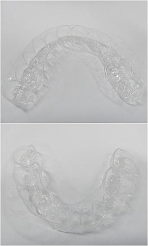 25.킬본교정 (3).jpg