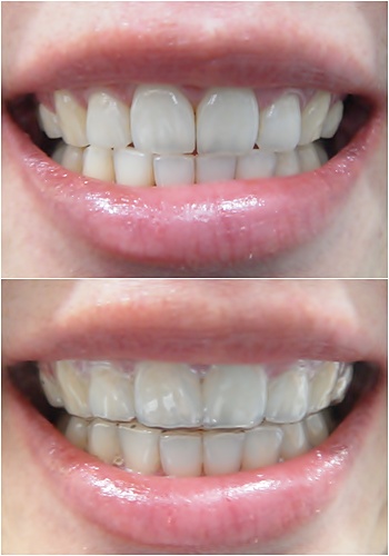 25.킬본교정 (5).jpg