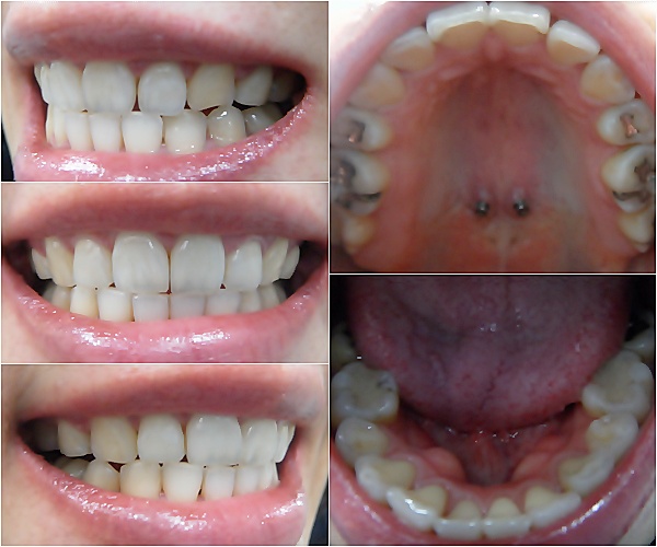 25.킬본교정 (2).jpg