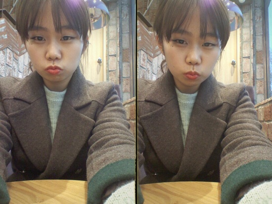 오라픽스 치아교정 포스팅 (2).jpg