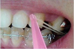 17.킬본교정 (11).jpg