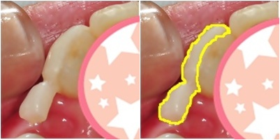 17.킬본교정 (3).jpg