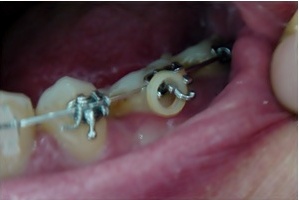 17.킬본교정 (10).jpg