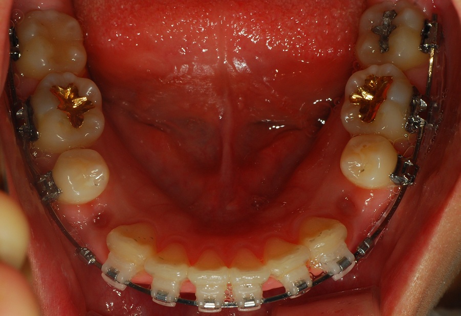 오라픽스 포스팅 사진 (6).jpg