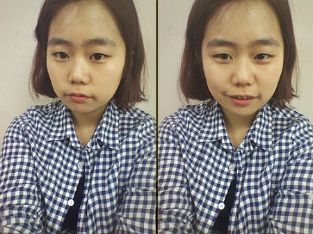 오라픽스 치아교정 포스팅(6).jpg