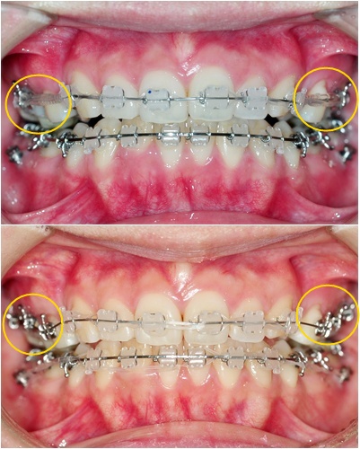 19. 킬본교정 (1).jpg