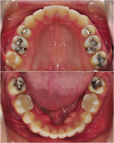 32. 킬본교정 (1).jpg