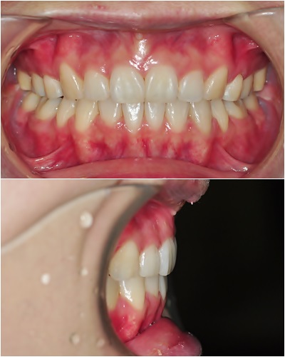 32. 킬본교정 (3).jpg