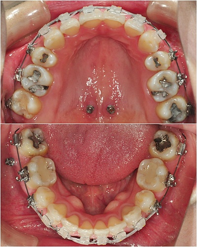 26.킬본교정 (3).jpg