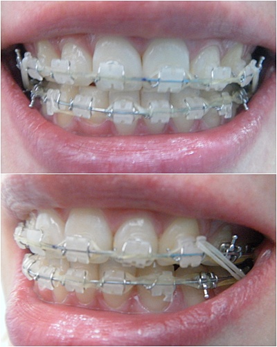 26.킬본교정 (8).jpg