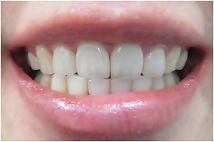 26.킬본교정 (6).jpg