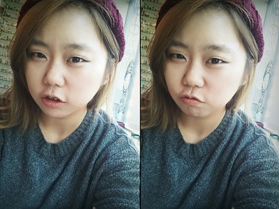 오라픽스 치아교정 포스팅 (4).jpg