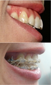 26.킬본교정 (2).jpg