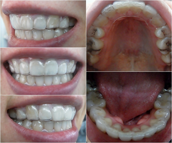 31.킬본교정 (4).jpg