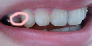 2011-07-14 09.21.59.jpg