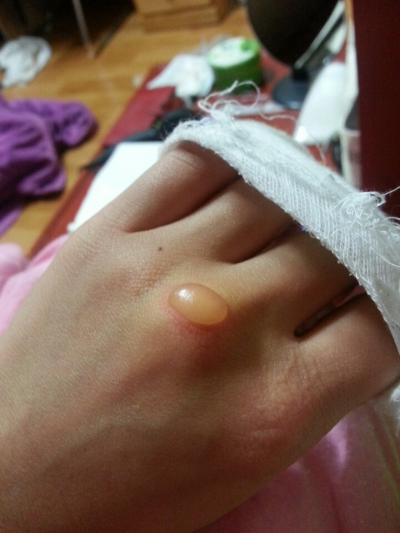 오라픽스 치아교정 포스팅 (2).png