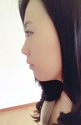 18. 킬본교정 (5)-.jpg