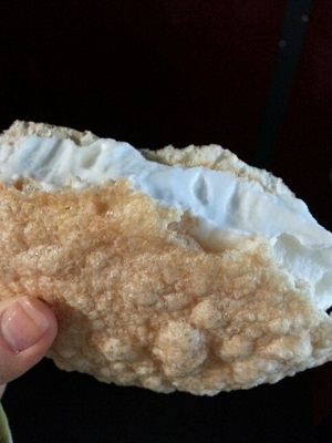 오라픽스 치아교정 포스팅 (8).jpg