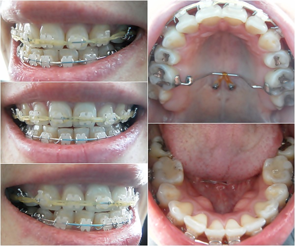 24.킬본교정 (1).jpg