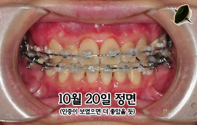 jung141020h.jpg