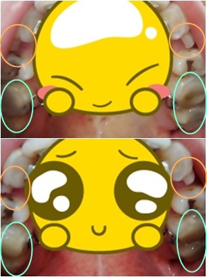 16.킬본교정 (1).jpg