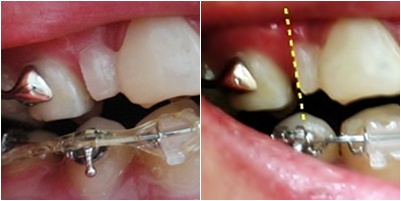 16.킬본교정 (2).jpg