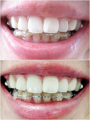 16.킬본교정 (5).jpg