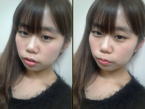 오라픽스 치아교정 포스팅(3).jpg