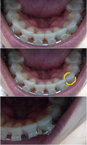 27. 킬본교정 (1).jpg