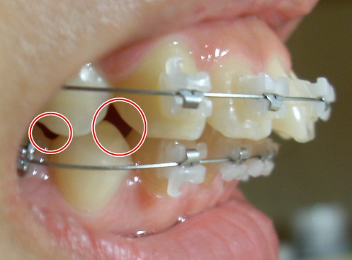오라픽스 포스팅 사진 (8).JPG