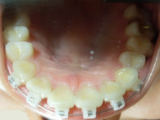오라픽스 포스팅 사진 (6).JPG