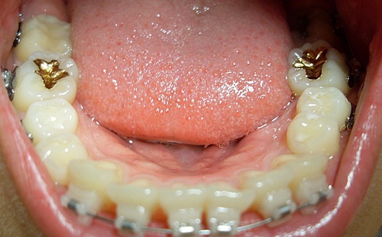 오라픽스 포스팅 사진 (5).JPG