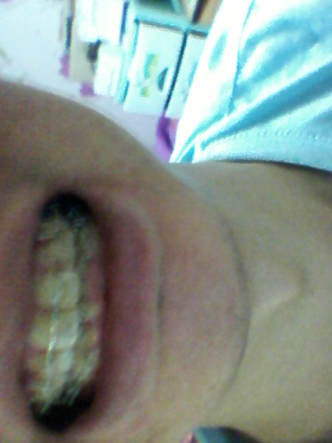 2011-11-21 01.06.34.jpg