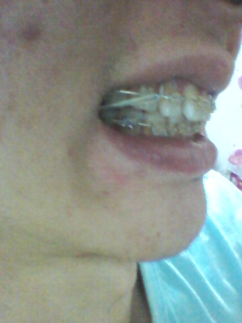 2011-11-21 00.43.12.jpg