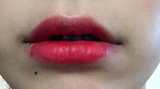 교정후기 20_1.jpg